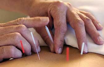 Acupunturista Adriana - Foto 1