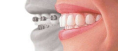 plano-odontologico-carapicuiba-1480365828